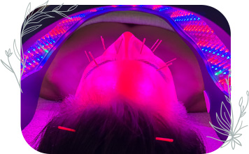 【肌本来の力を呼び覚ます】美容鍼×セルーマ